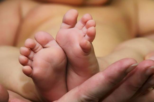 Eczema: Symptoms, Causes & Treatment